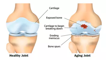 [Picture: Joints]